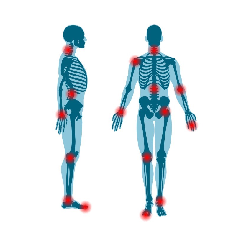 Rheumatology